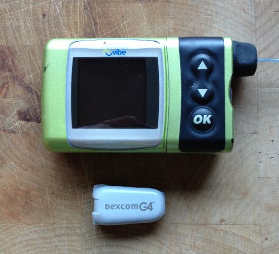 Animas Vibe & Dexcom G4