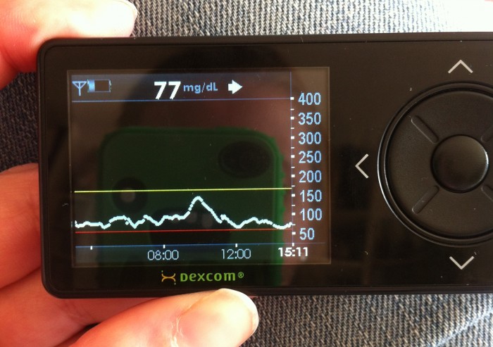 Dexcom G4 Standalone