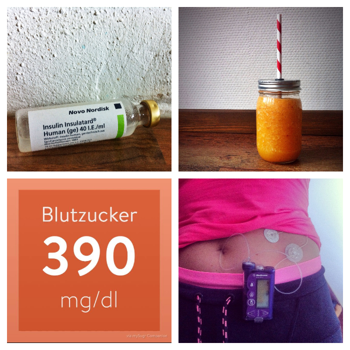 Die Diabetes-Woche bebildert