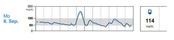 Blutzuckerverlauf