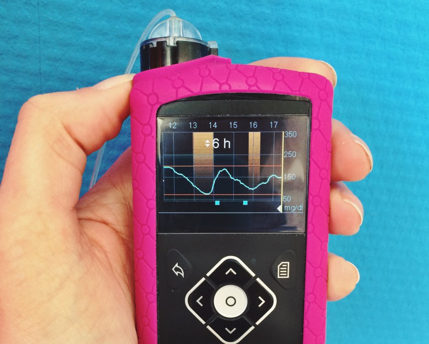 Insulinpumpe Minimed 640G