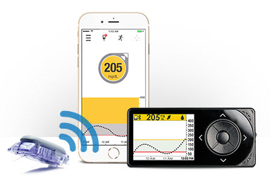 © by Dexcom (http://www.dexcom.com/de-DE)