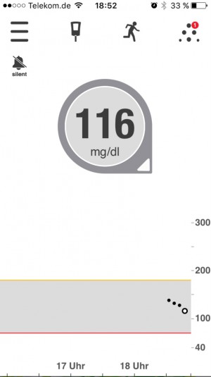 Dexcom_5