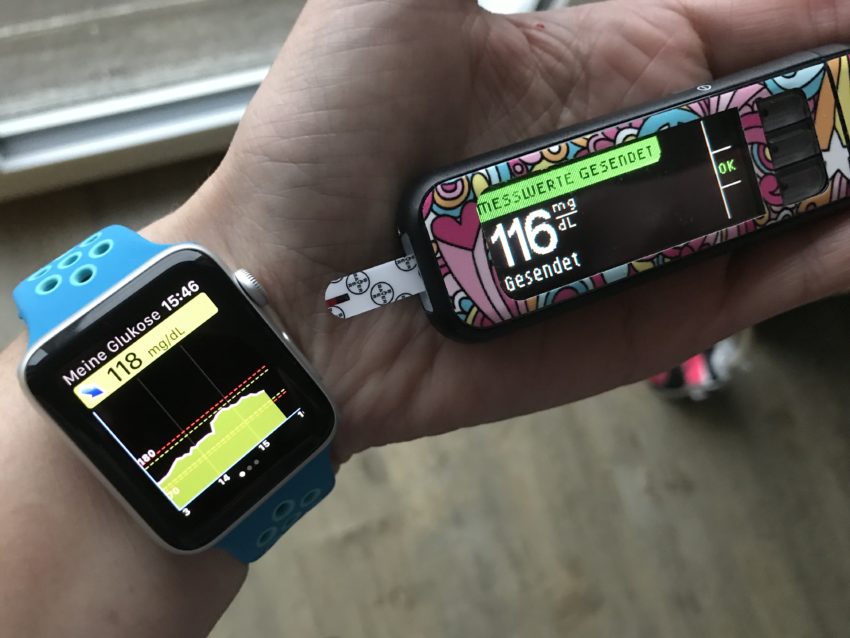 Eversense mit Apple Watch